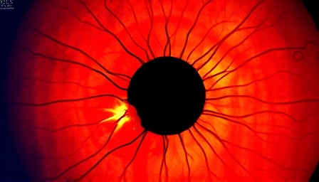 Kodiak Sciences Faces Financial Challenges Amid Biotech Volatility Kodiak Sciences Faces Financial Challenges Amid Biotech Volatility