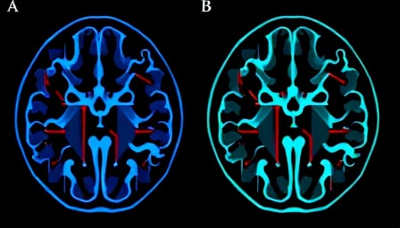 US Neurosurgical Holdings Inc: Pioneering the Future of Advanced Neurosurgical Care