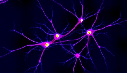 Vistagen Therapeutics: Pioneering Future CNS Treatments Amid Market Volatility